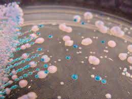 A look at the new fungus Candida Auris